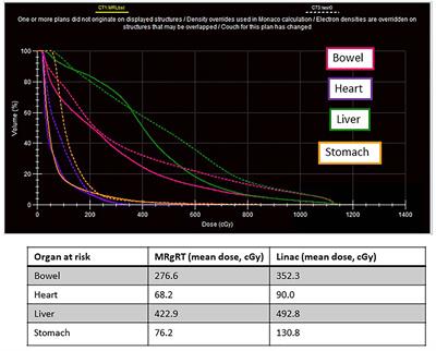 Initial clinical applications treating pediatric and adolescent patients using MR-guided radiotherapy